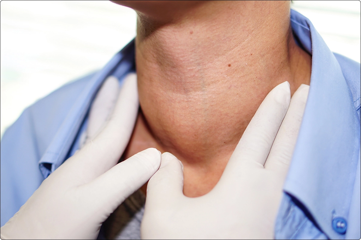 patient with enlarged thyroid being examined